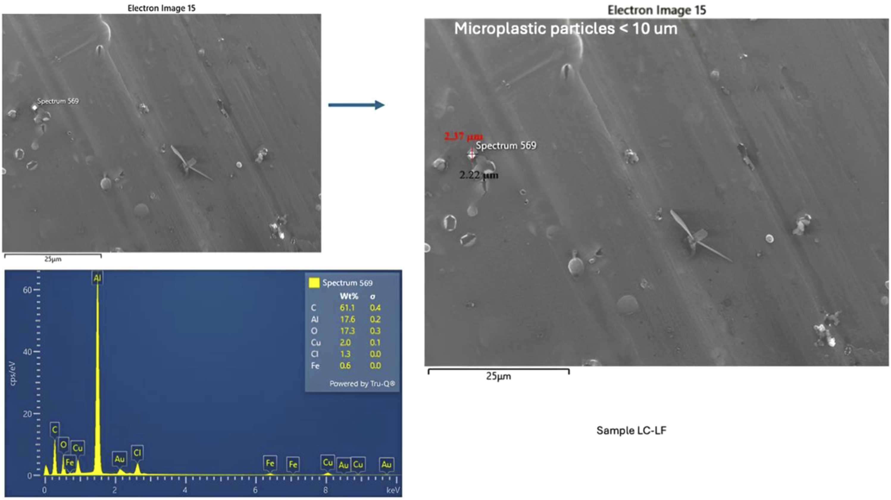 Microplastics in ovarian follicular fluid